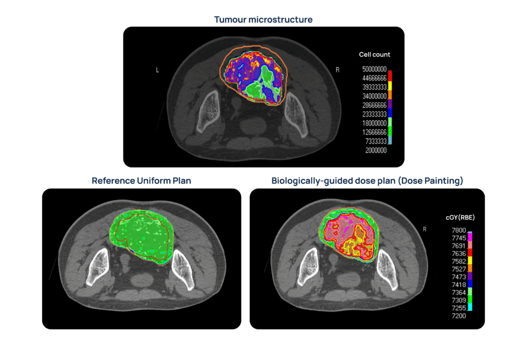 WP3 – Generation of Patient-Specific Microstructural and Radiobiological Models